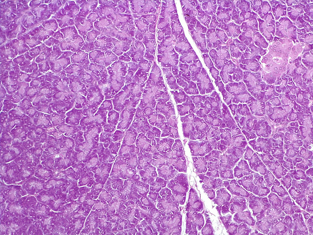 Pancreas Slides - Pancreas 016 400X